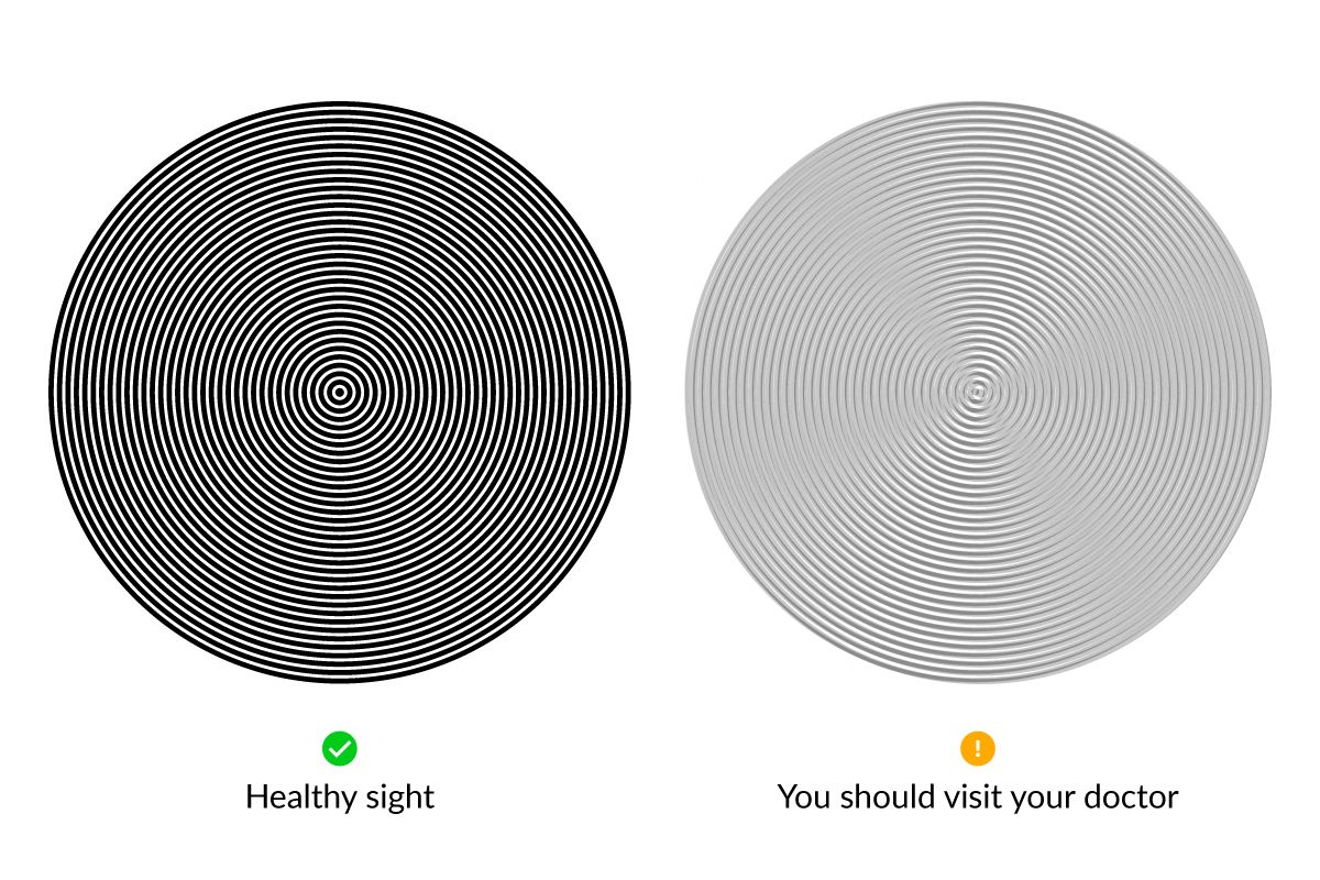 test ocular online pentru astigmatism